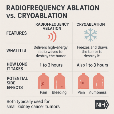 Ablation for kidney cancer explained