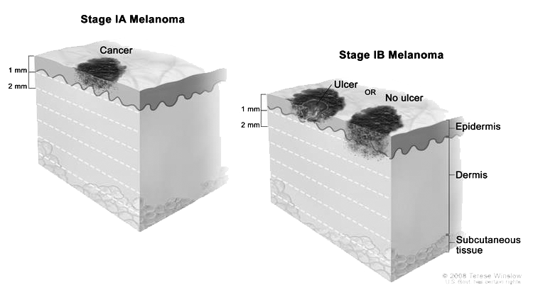 guide image